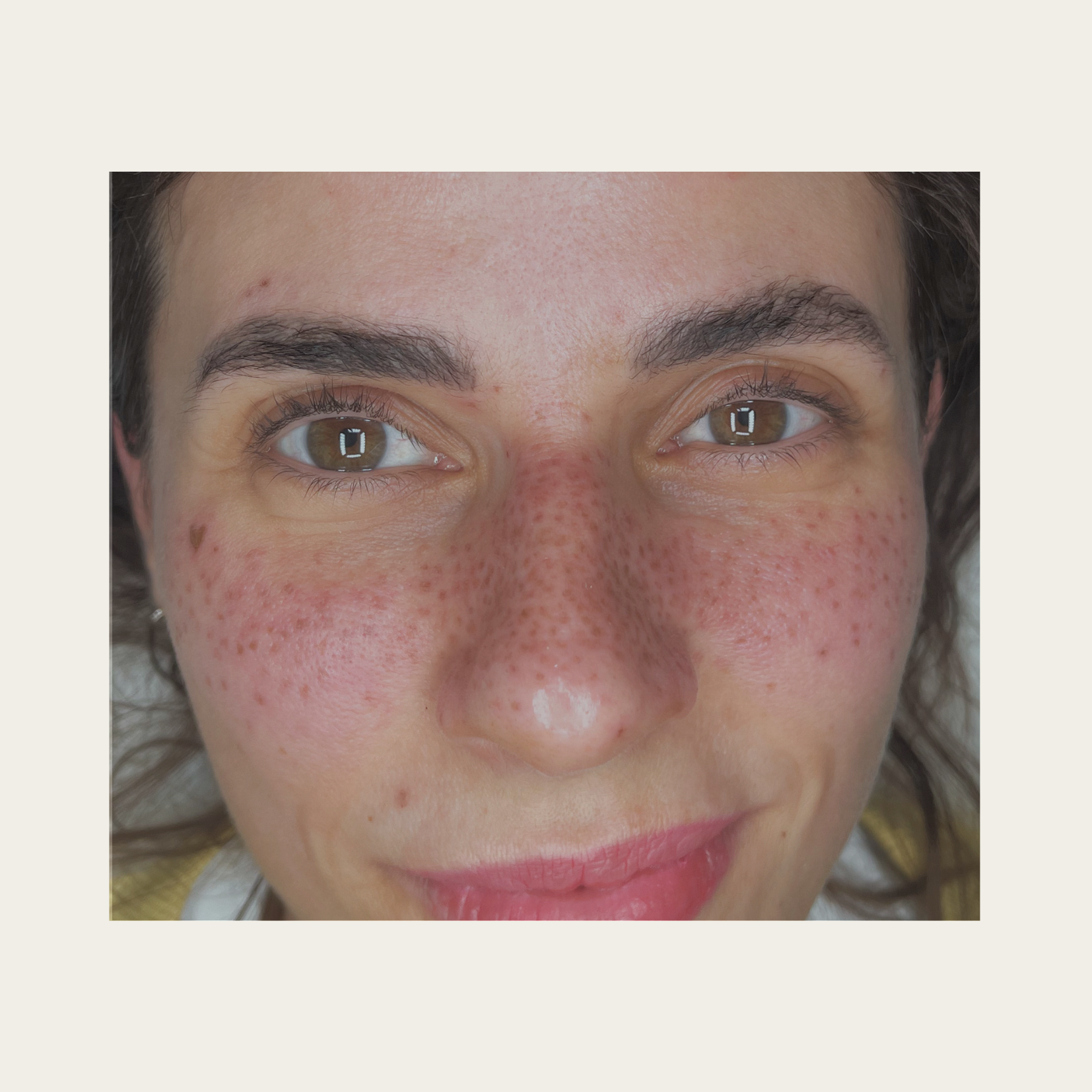 Fake Freckles – natürliche Sommersprossen ohne Filter