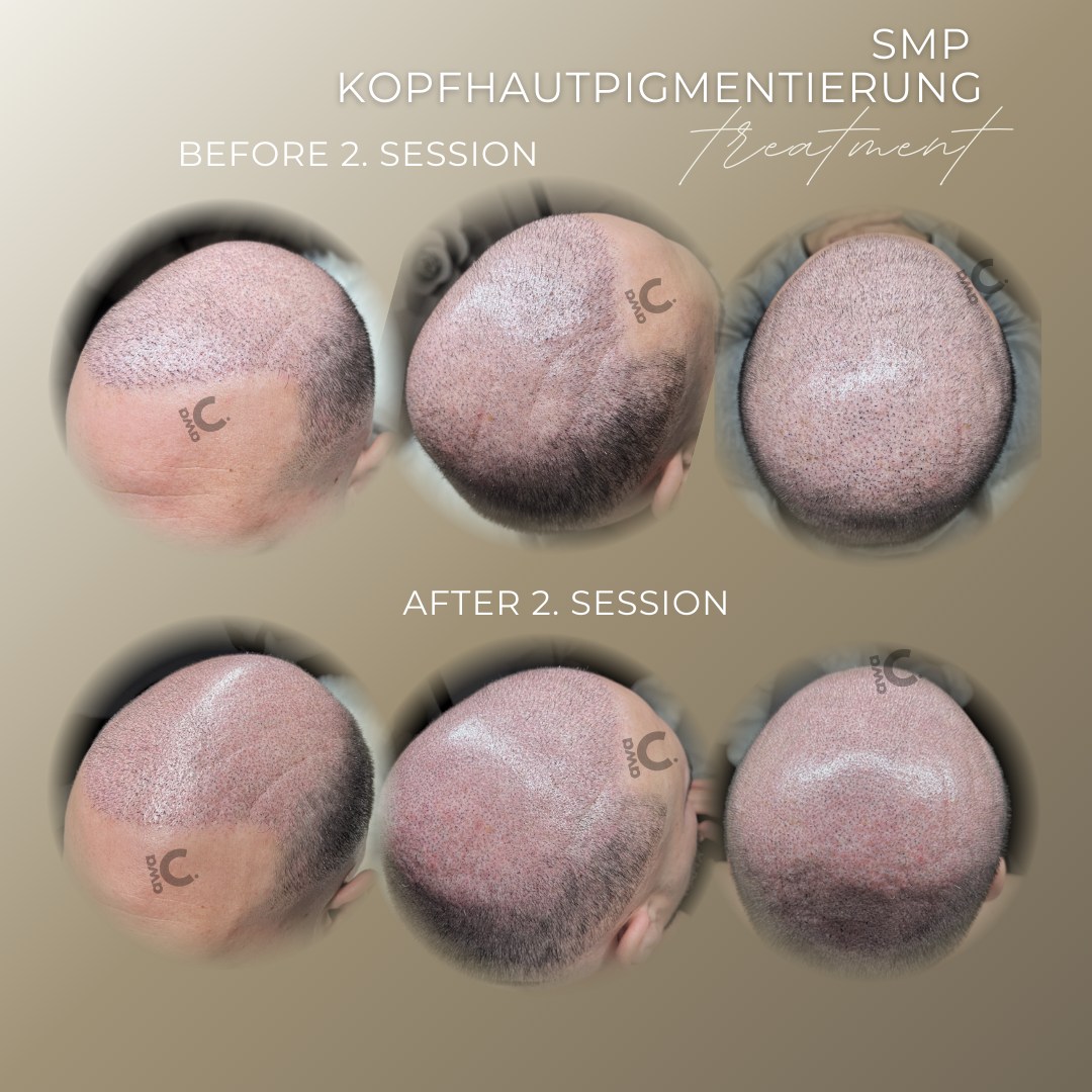 Haarpigmentierung 4D in Grevenbroich
