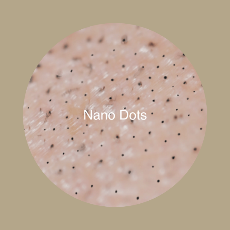 Nano Dots Scalp Micropigmentation