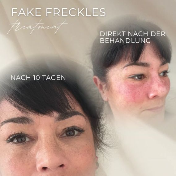 Fake Freckles in Grevenbroich