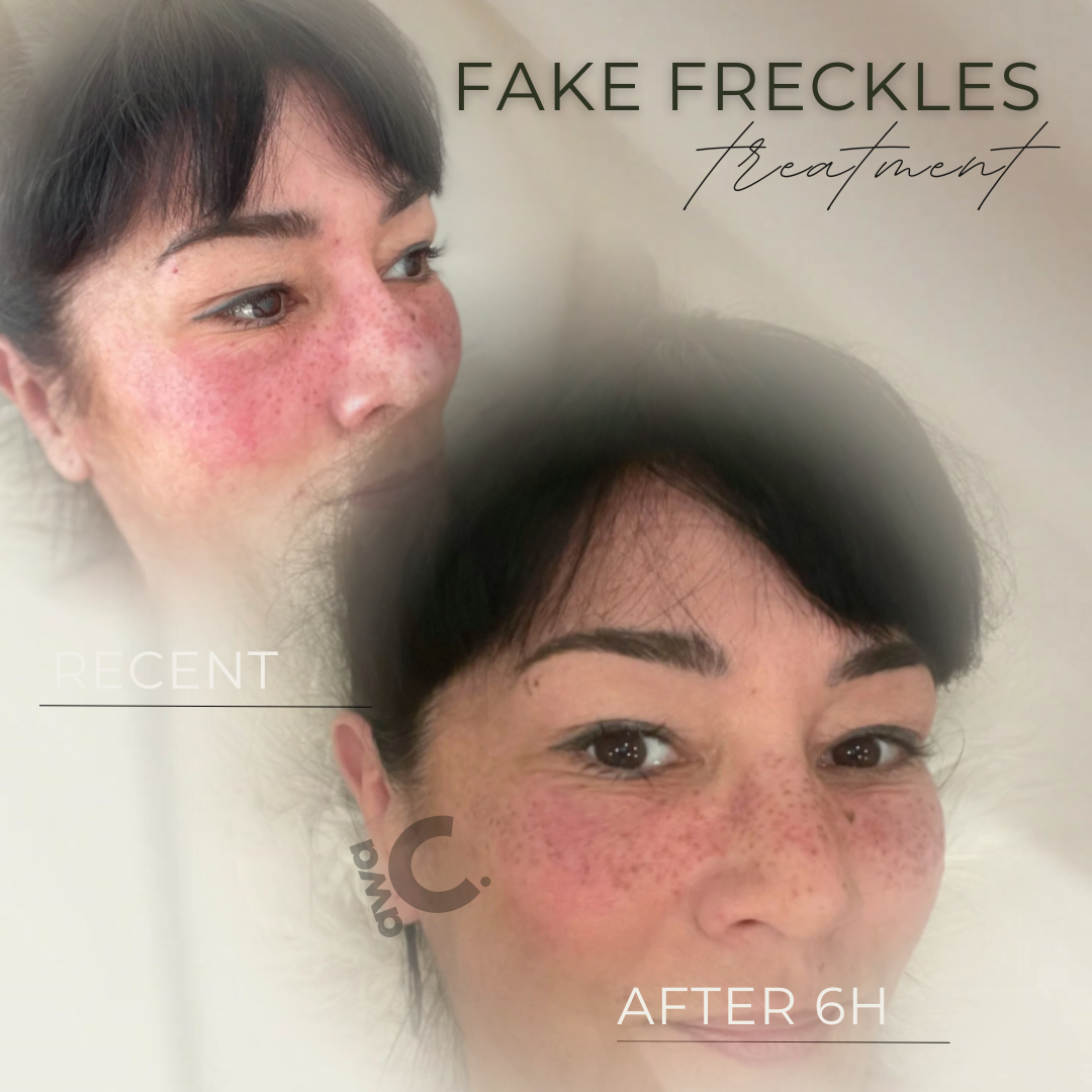 Fake Freckles permanente Sommersprossen