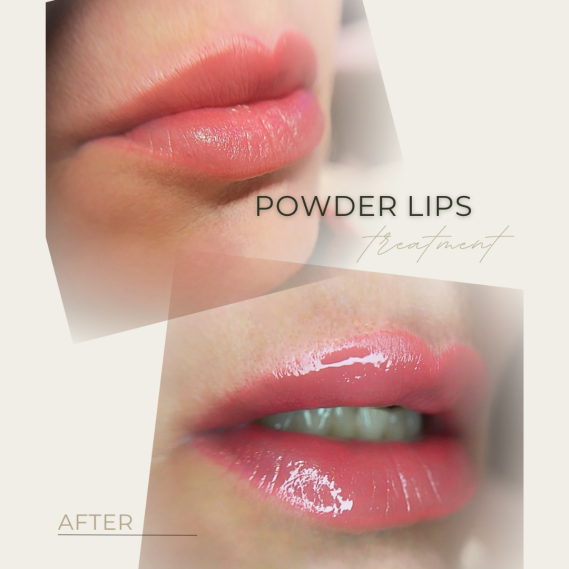 Powder Lips Vorher Nachher in Grevenbroich