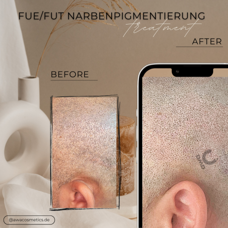 Vorher/Nachher Haarpigmentierung