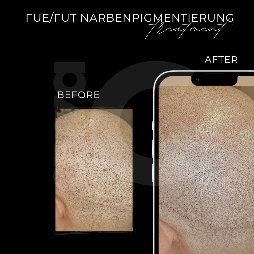 Haarpigmentierung in Grevenbroich