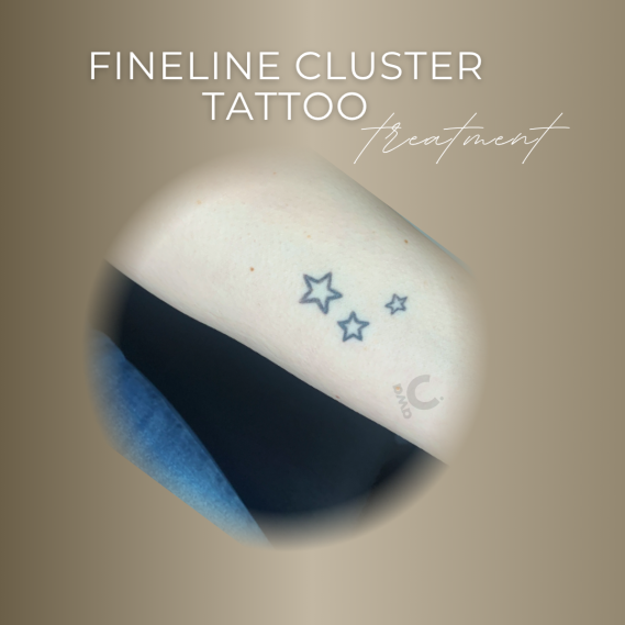 Kundenergebnis Fineline-Tattoo Sternencluster