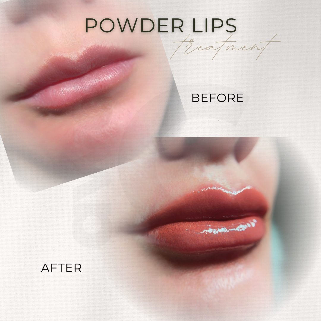 Vorher Nachher Lippen Permanent Make-up