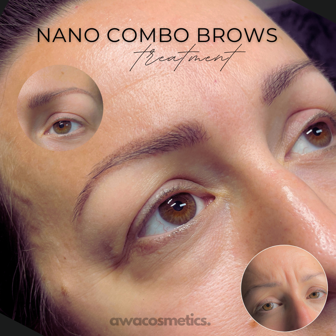 Vorher Nachher Nano Combo Brows