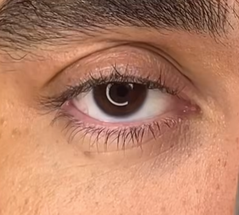 Haarpigmentierung Kopfhautpigmentierung 4D bei Glatze oder lichtem Haar in Grevenbroich