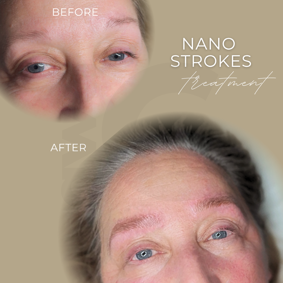 Nano Strokes in Grevenbroich