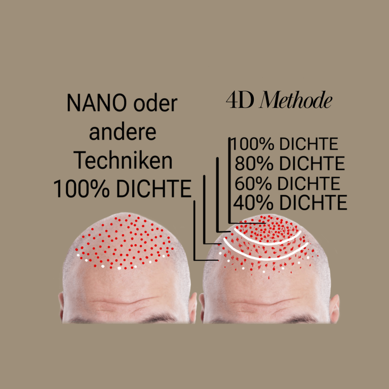 Dichte Nano Pigmentierung vs. 4D Mehtode