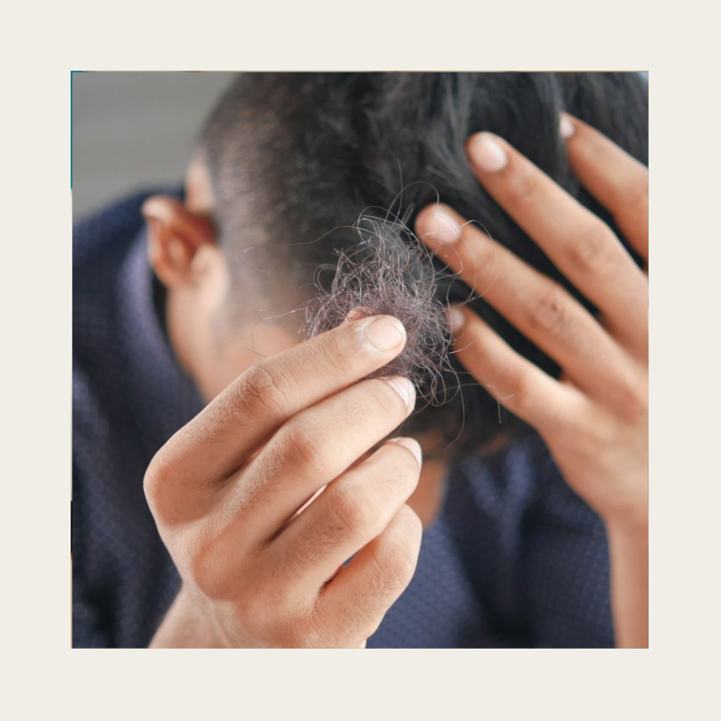 Haarverdichtung SMP bei lichtem schütteren Haar Geheimratsecken bei awacosmetics