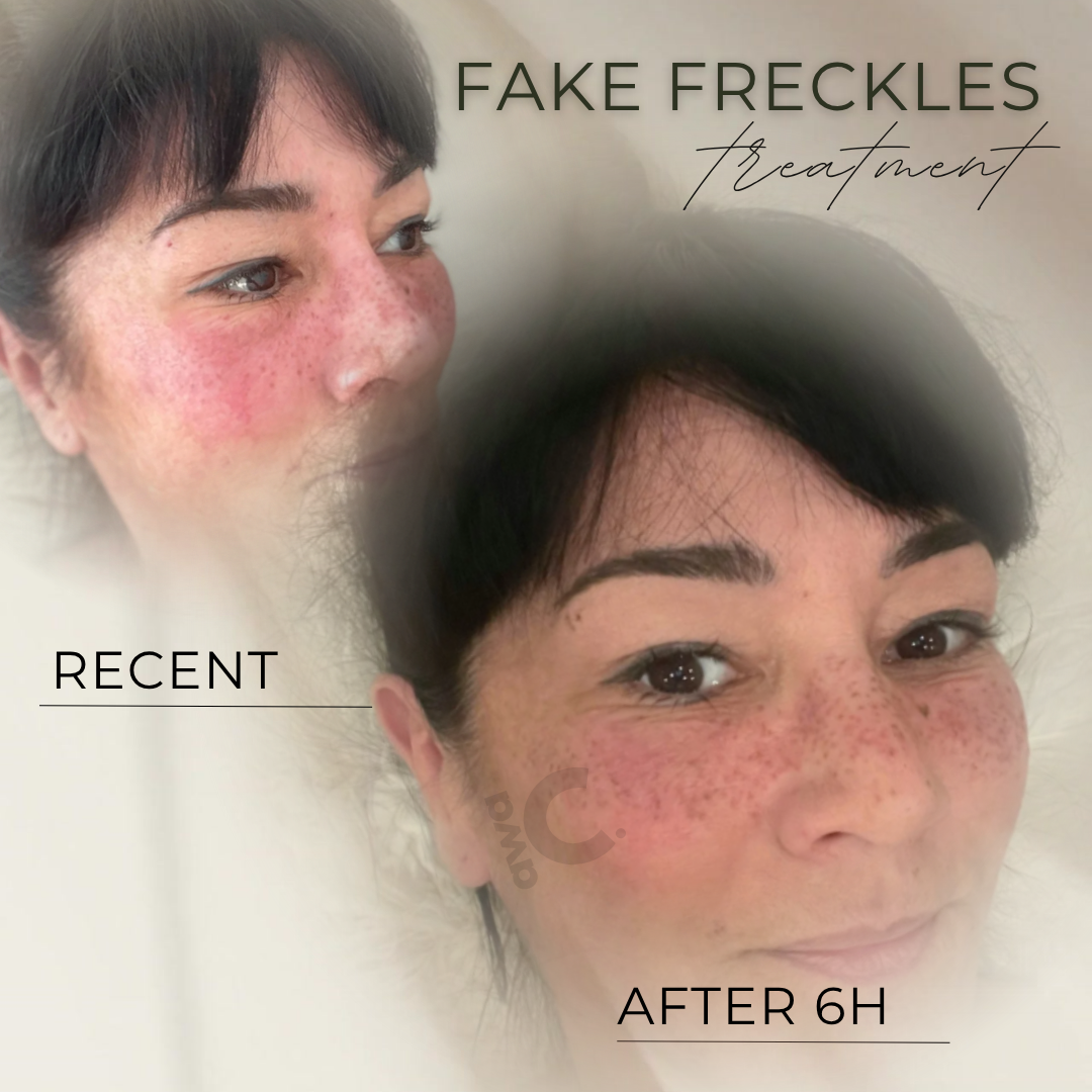 Fake Freckles in Grevenbroich