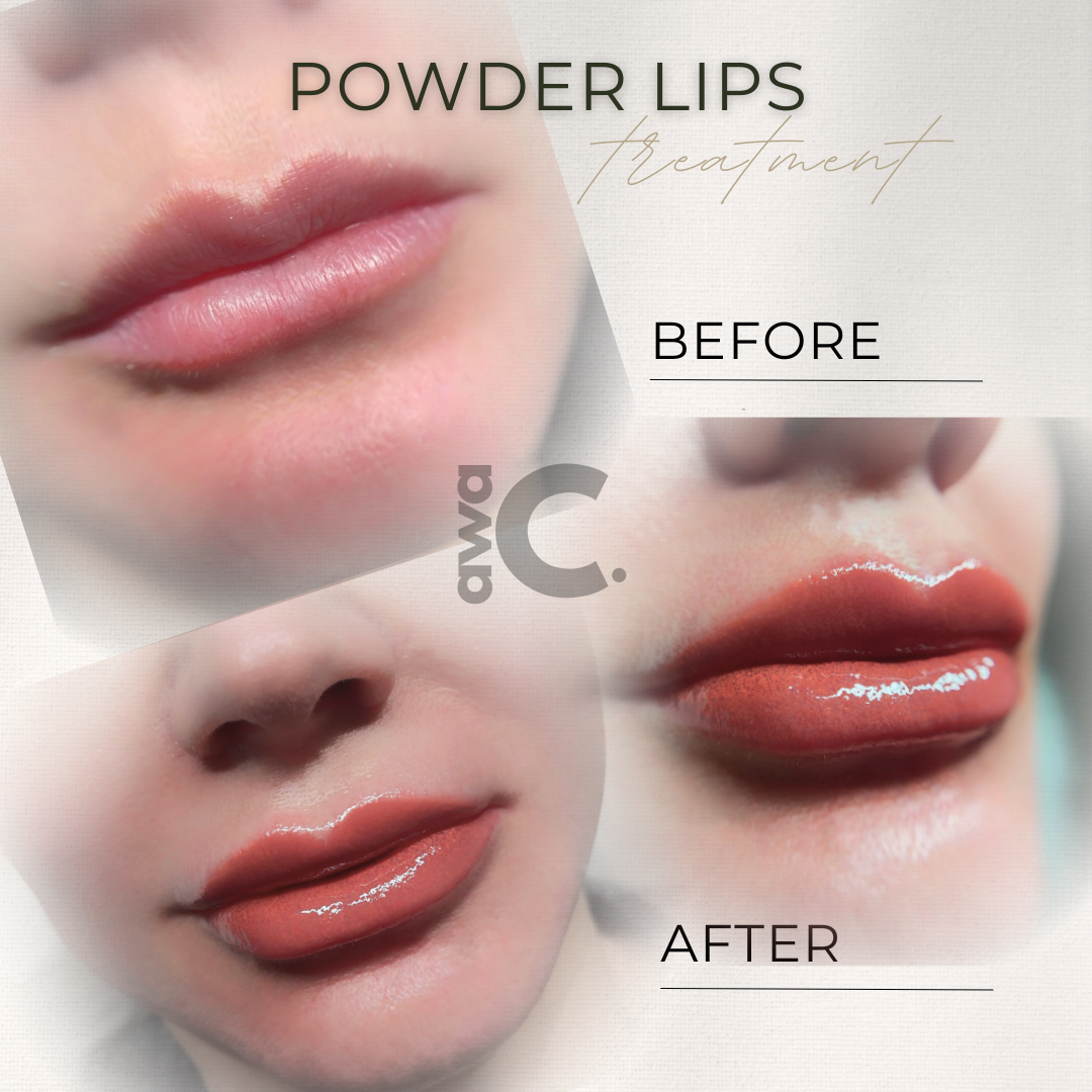 Vorher Nachher Lippen Permanent Make-up