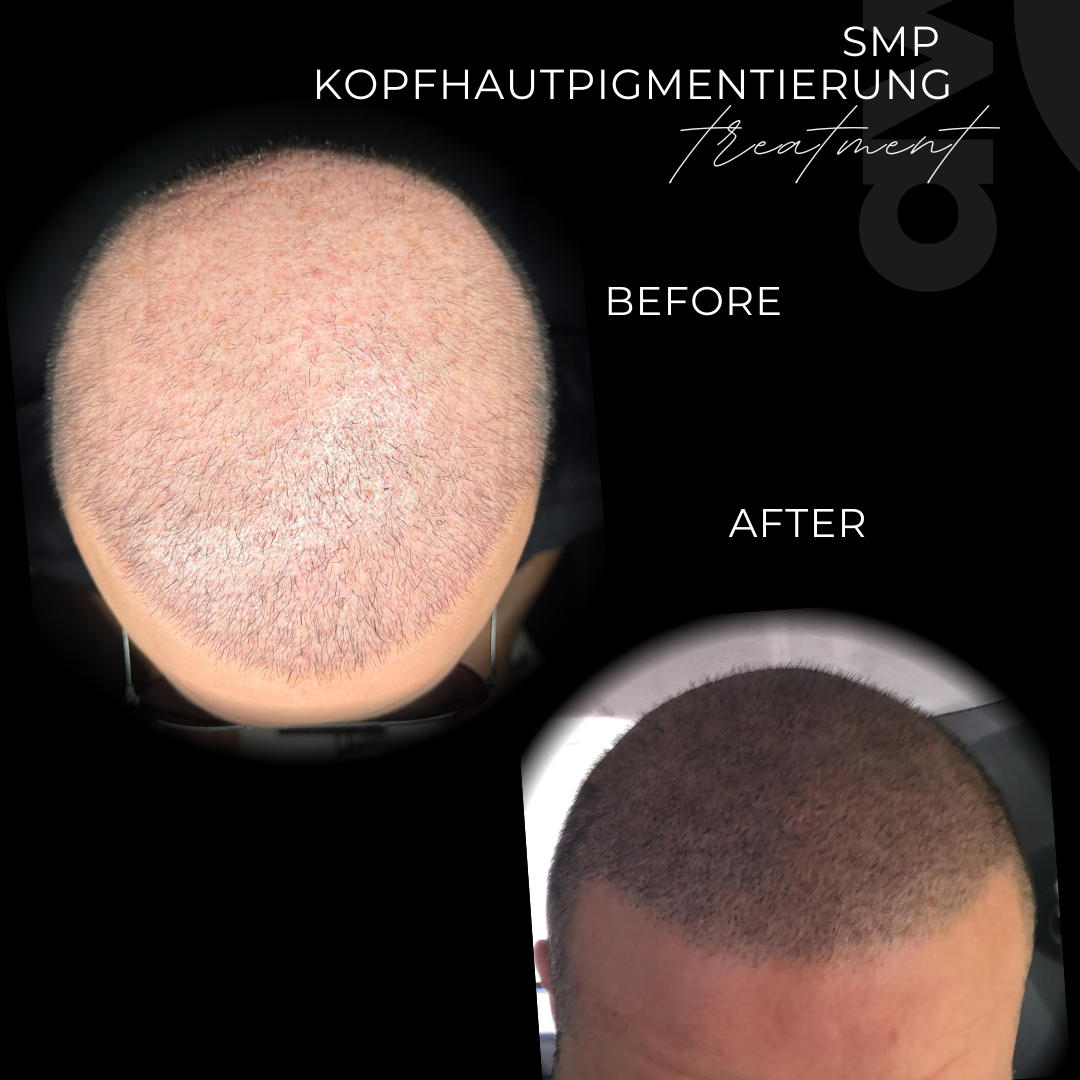 Haarpigmentierung 4D in Grevenbroich