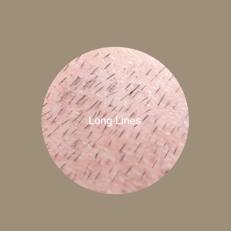 Long Lines