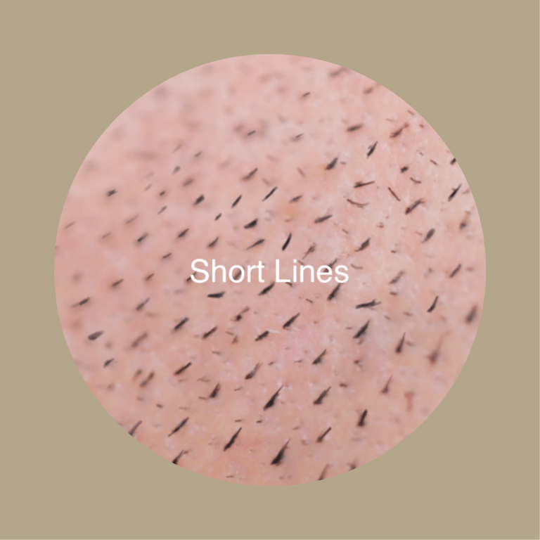 Short Lines Haarverdichtung