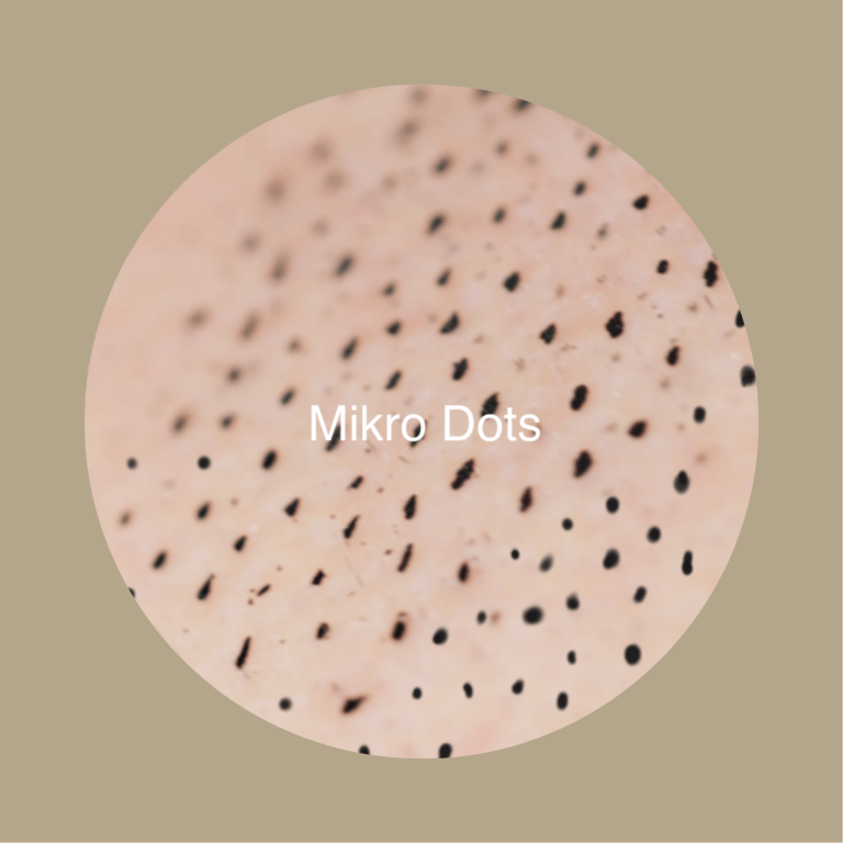 Mikro Dots SMP