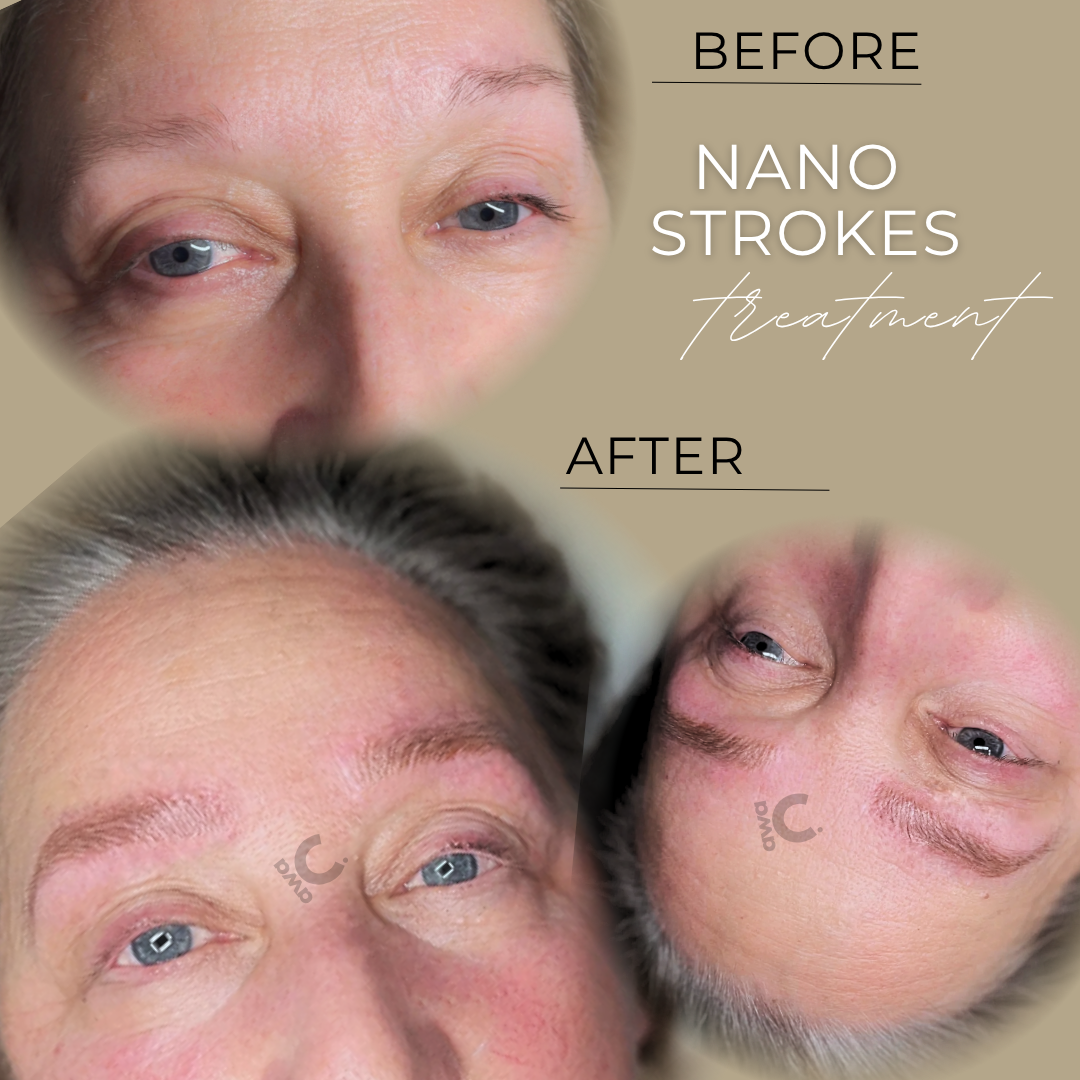 Nano Strokes in Grevenbroich