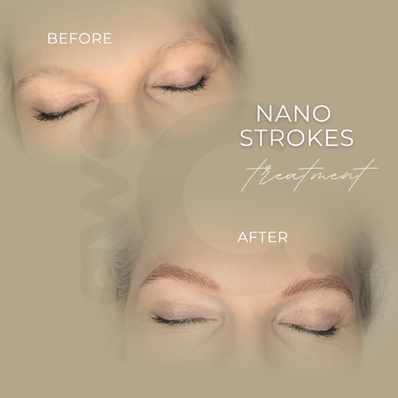 Vorher-Nachher-Darstellung eines Nano Brows-Behandlungsergebnisses für Augenbrauen, Härchenzeichnung maschinell pigmentiert.